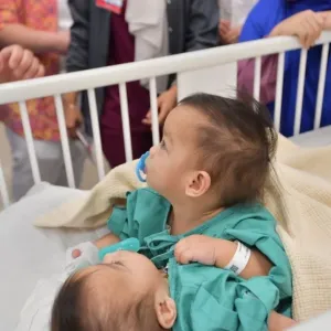 بمشاركة 23 طبيبا.. بدء عملية فصل التوأم السيامي "أكيزا وعائشة" في السعودية (فيديو+ صور)