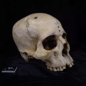 كيف كانت العمليات الجراحية قبل 4 آلاف عام؟.. جمجمة فرعونية تكشف السر