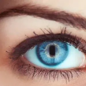 ما العلاقة بين جفاف العيون والصداع وطرق التخلص منها؟