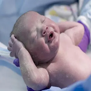 متلازمة ضيق التنفس عند حديثي الولادة.. إليك أسبابها