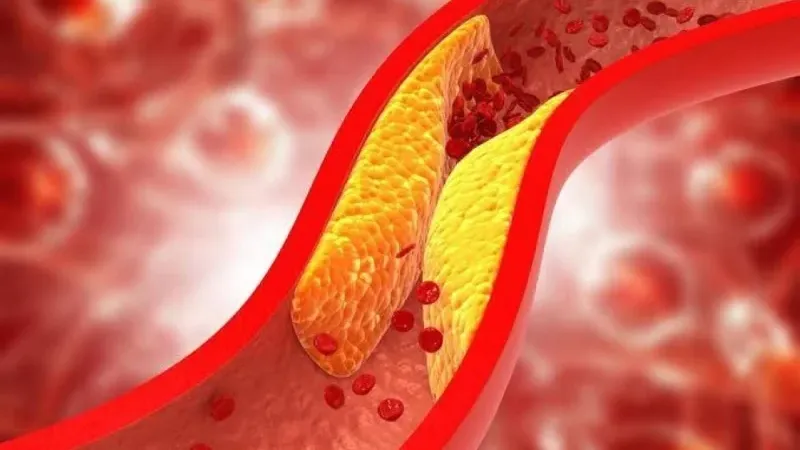 الكشف عن فاكهة شهيرة تخفض الكوليسترول وتقلل خطر الإصابة بأمراض القلب والسرطان