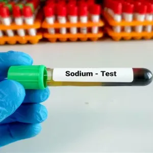 حسام موافي: تحليل الصوديوم بالدم ضروري في هذه الحالة