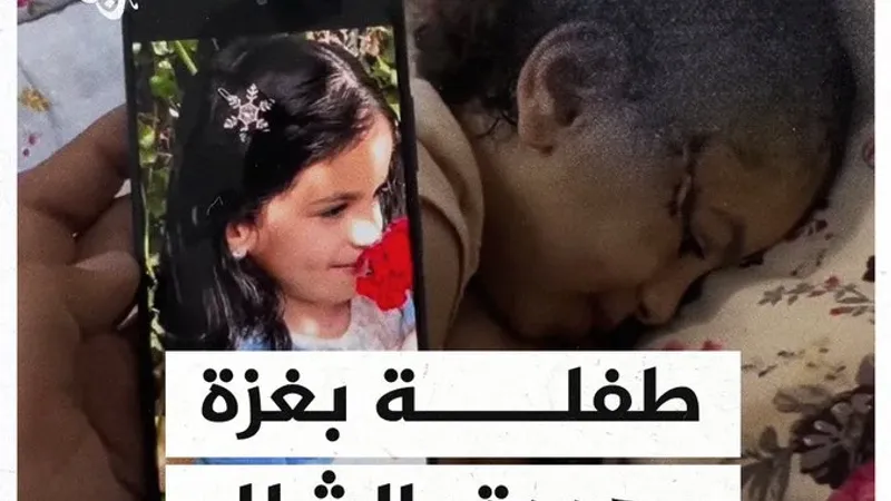 عبر "𝕏": "نفسي أركض وألعب".. استغاثة لعلاج طفلة مُهددة بالشلل لإصابتها بشظية برأسها #حرب_غزة