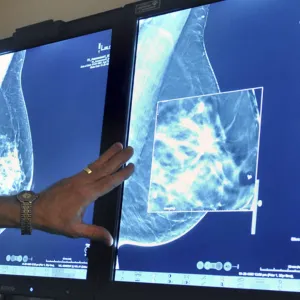 دراسة جديدة: علماء يكشفون الأثر الإيجابي لبذور الكتان في الوقاية من سرطان الثدي