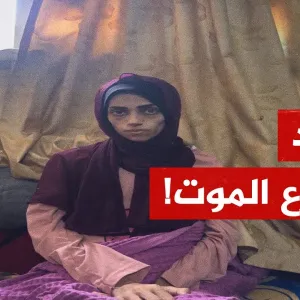 شابة من غزة تعاني من مرض السرطان بحاجة إلى السفر للعلاج