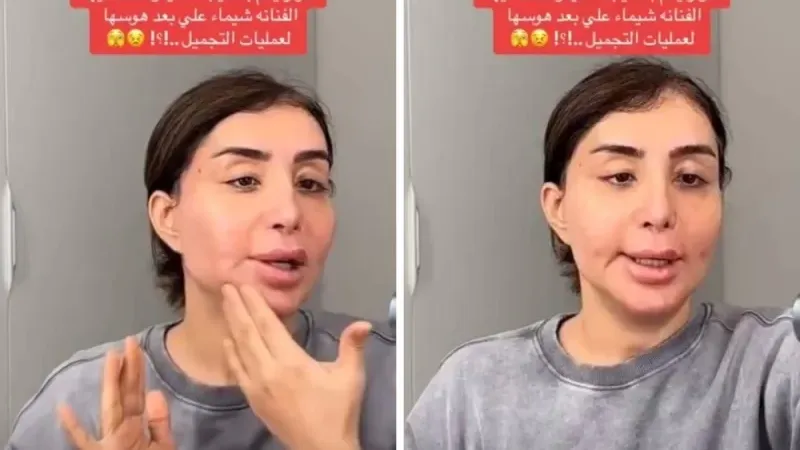 شاهد.. الفنانة "شيماء علي" تفاجئ متابعيها بتغير شكلها في أحدث ظهور لها