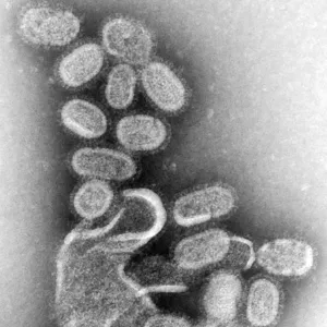 الأنفلونزا.. العامل الأكثر خطورة وبائياً