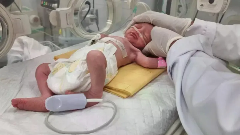أعلن طبيب فلسطيني، أنّ الطفلة "صابرين الروح" توفيت بعد أيام قليلة من إخراجها من رحم أمها القتيلة في مستشفى بغزة. https://arabic.euronews.com/2024/04/2...