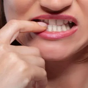 الأسنان السائبة- دليلك للتعامل معها