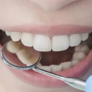 الإعلان عن دواء جديد يعمل على نمو الأسنان مرة أخرى
