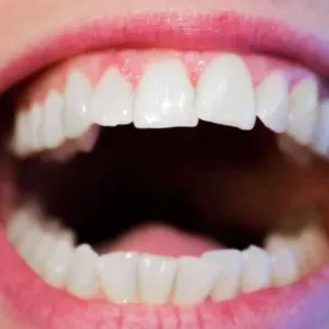 أخطرها الزهايمر.. 4 أمراض مرتبطة بـ«ميكروبيوم الفم»