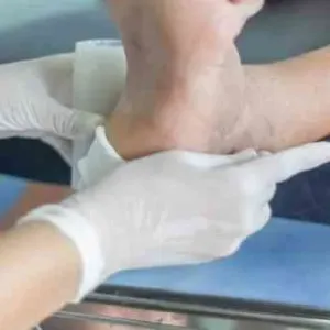 جوارب إلكترونية "تنهي" عذاب تقرحات القدم لدى مرضى السكري