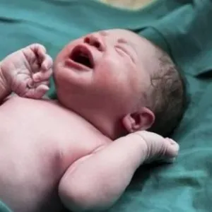 43 % تراجعاً في الولادات القيصرية بمصر