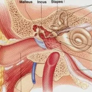 لماذا تزداد حالات الإصابة بالتهاب الأذن الوسطى بعد التعافي من كورونا