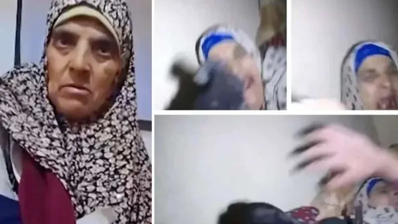 السيدة الفلسطينية ضحية هجوم الكلب الإسرائيلي: لا أنام الليل من الرعب والألم