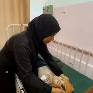 التصق جلده بعظمه.. والدة طفل يعاني من الجوع في غزة: أفقد ابني أمام عيني