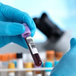 اختبار دم جديد يحذر من الإصابة بالسرطان قبل سبع سنوات !