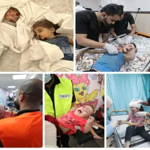 منظمة حقوقية: 10 أطفال يفقدون سيقانهم يوميا بغزة