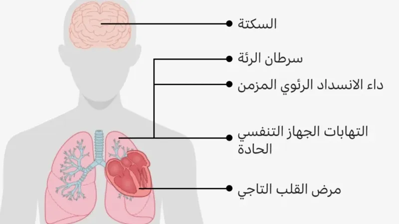 كيف يقتلنا تلوُّث الهواء في صمت؟