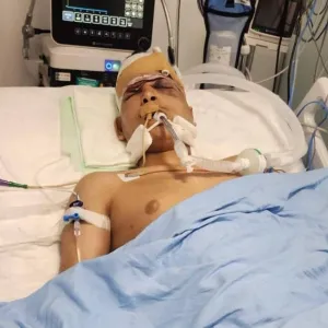 استشهاد فتى فلسطيني متأثرا بجراحه خلال قمع أمن السلطة مسيرة في جنين