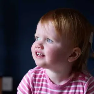 أمل جديد.. نجاح أول تجربة للعلاج الجيني باستعادة طفلة بريطانية حاسة السمع (تفاصيل)
