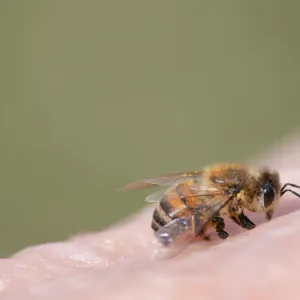 في حالة نادرة.. نحلة تلدغ رجلا في عينه وتترك مضاعفات خطيرة