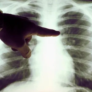 هل تؤثر أمراض الرئة على القلب؟
