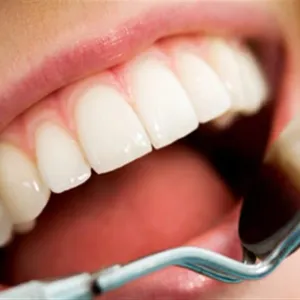 7 أطعمة تساعد في الحفاظ على صحة الأسنان