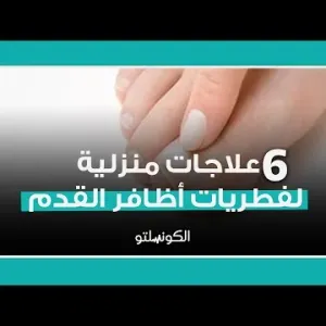 6 علاجات منزلية لفطريات أظافر القدم