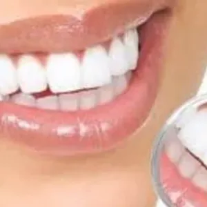 استشارى يجيب عن السؤال: هل تفيد وصفات الإنترنت فى تبييض الأسنان؟