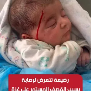 رضيع فلسطيني (20 يوم) يتعرض للإصابة بسبب القصف المتواصل على #غزة