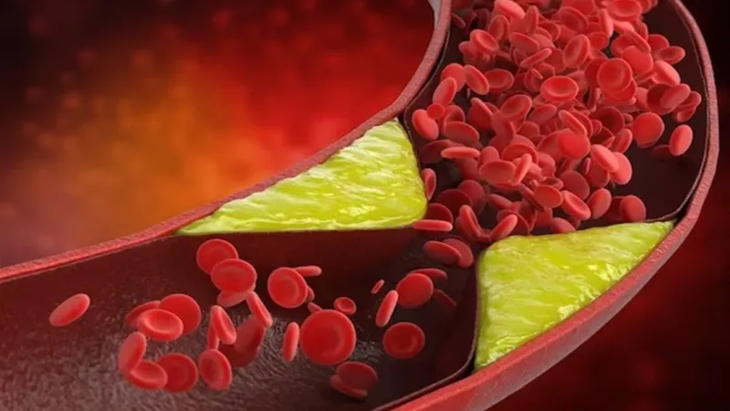 دراسة تكشف - هل يخفض الثوم مستوى الكوليسترول الضار في الدم؟