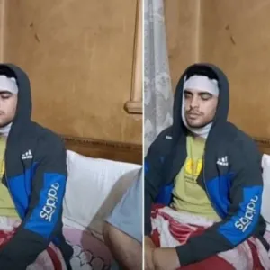 طالب مصري يشوه وجه زميله الجامعي بآلة حادة ويصيبه بـ115 غرزة..لسبب غريب!