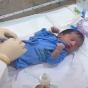أول حالة ولادة على جبل عرفات