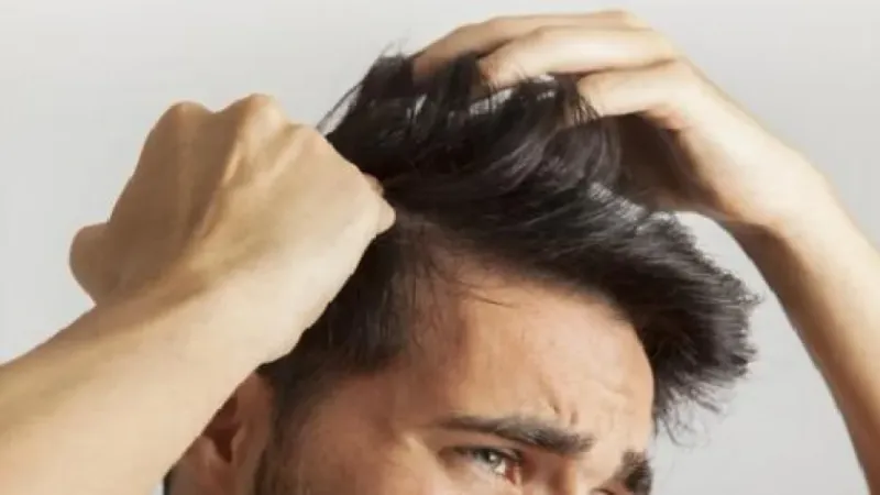 4 أسباب لزيادة قشرة الشعر في الصيف.. نصائح فعّالة للتخلص منها