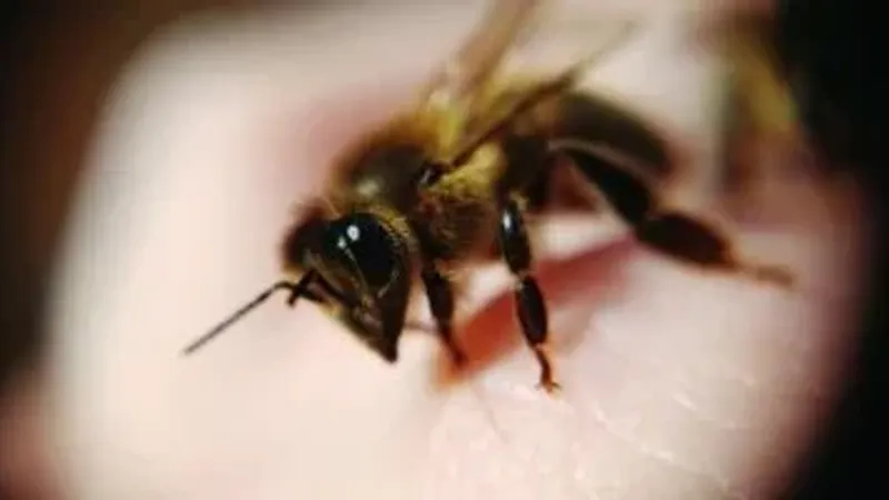 ماذا تعرف عن العلاج بسم النحل ؟ .. الفوائد والآثار الجانبية