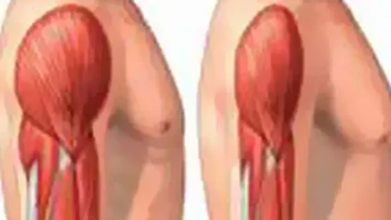 أشهر أسباب وأعراض تيبس العضلات