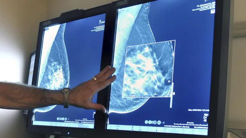 دراسة جديدة: علماء يكشفون الأثر الإيجابي لبذور الكتان في الوقاية من سرطان الثدي