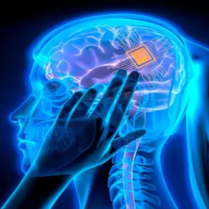 الشريحة الدماغية لـ"نيورالينك" تواجه مشاكل في أول تجربة عملية لها