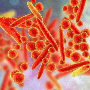 تحذير من زيادة كبيرة في الإصابة ببكتيريا تسبب التهاب الجهاز التنفسي