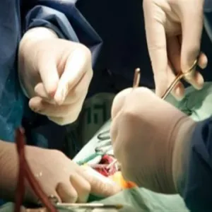«مصر» تنفي انتشار تجارة الأعضاء البشرية بين الأطباء