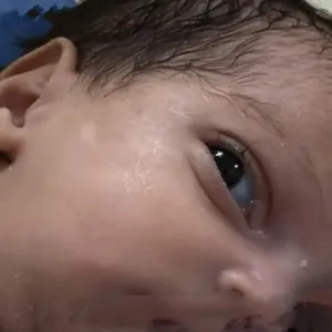بالفيديو| استخراج طفلة من رحم سيدة شهيدة في غزة