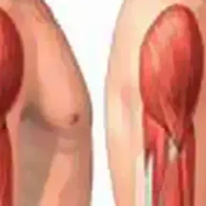 أشهر أسباب وأعراض تيبس العضلات