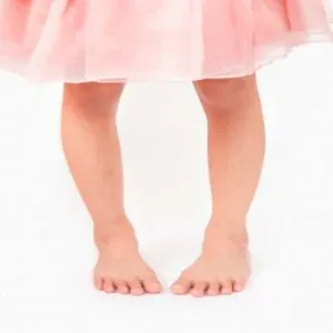 أنواع تشوهات القدم عند الأطفال