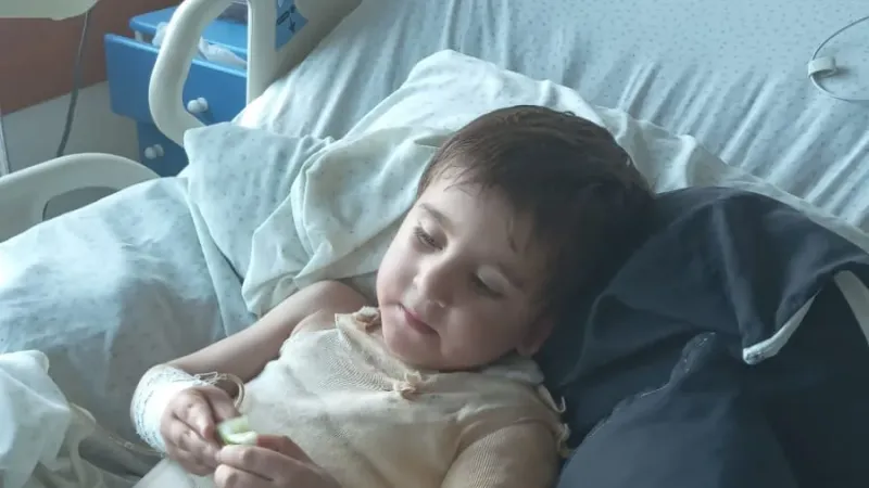 عمر ابن الثلاث سنوات يعاني حروقاً من الدرجتَين الثانية والثالثة: صرخة استغاثة
