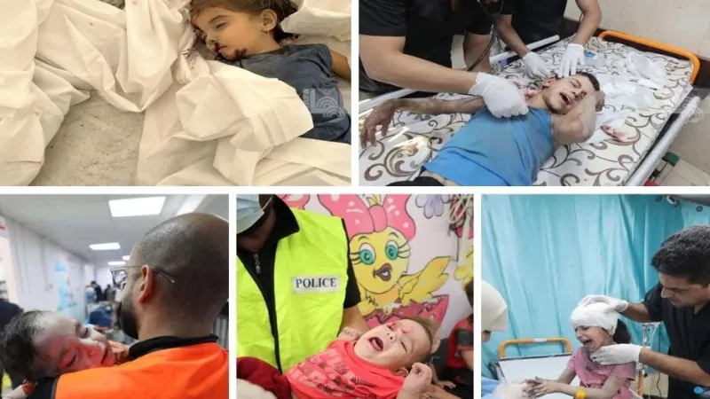 الصحة بغزة: (29) شهيدا خلال 24 ساعة وارتفاع حصيلة العدوان إلى (34,683) شهيدا